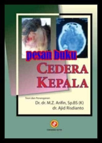 Image of Cedera Kepala 